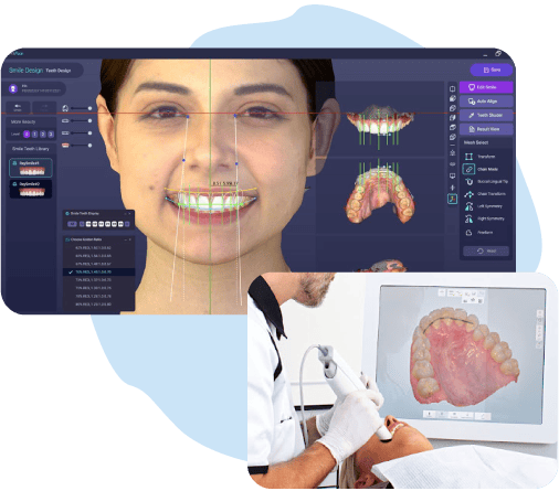 facial-scanner facial scanner