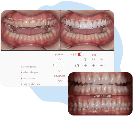 image-facially-driven-functional-digital image facially driven functional digital