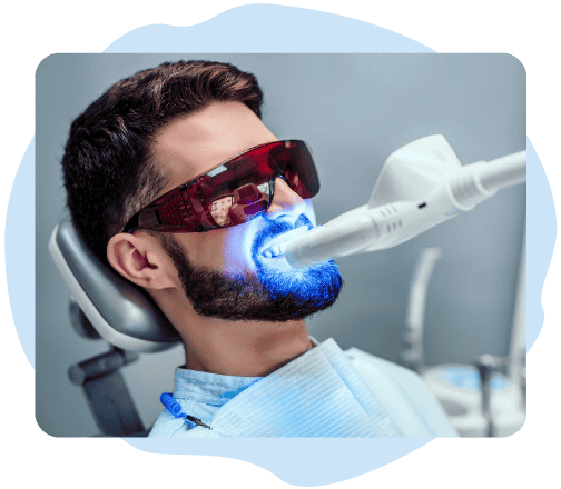 laser-teeth-whitening laser teeth whitening