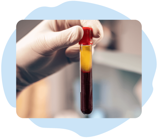 Τεχνική-PRF Τεχνική PRF